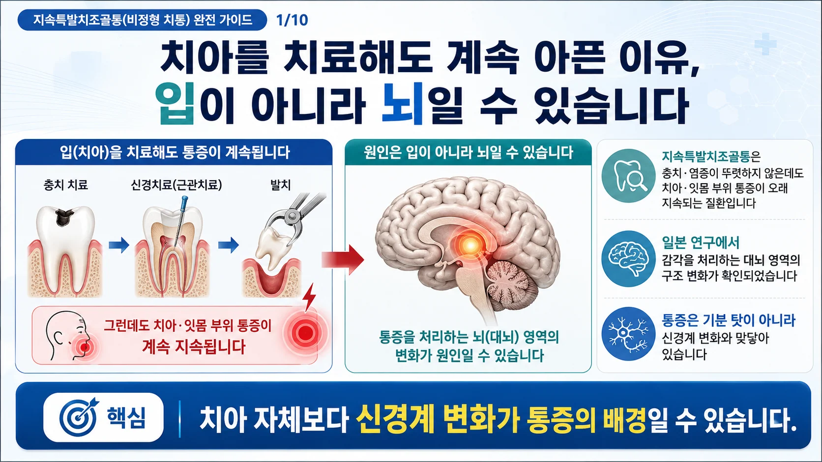 지속특발치조골통(비정형 치통), 통증의 원인이 뇌에 있다? — 중추신경계와 피질 가소성