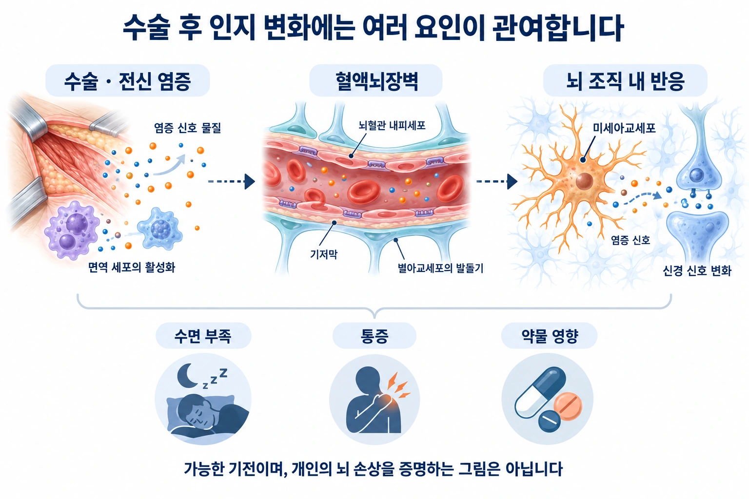 수술 후 염증 신호 혈액뇌장벽 미세아교세포의 가능한 연관 기전