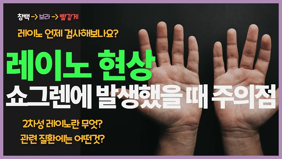 레이노 증후군과 쇼그렌증후군 #1