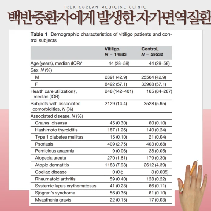 백반증과 자가면역질환 발생률