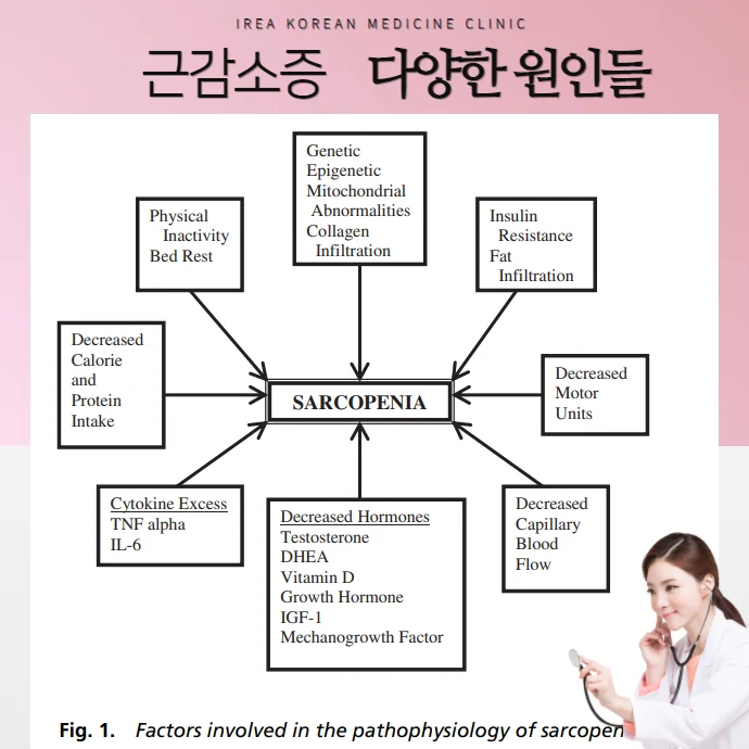자가면역질환과 근감소증 원인