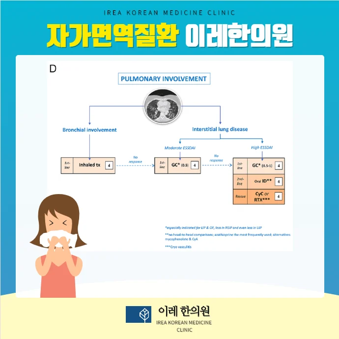 폐질환 치료 권고안