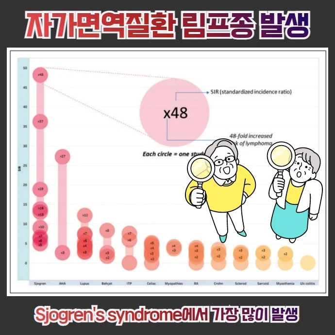 쇼그렌증후군과 림프종 #2
