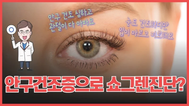 심한 안구건조증