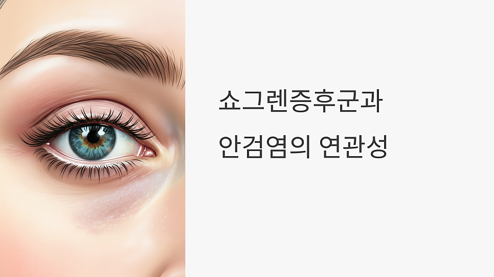 이미지 2