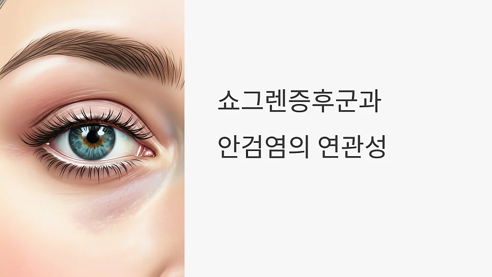 안검염 증상과 원인 #2