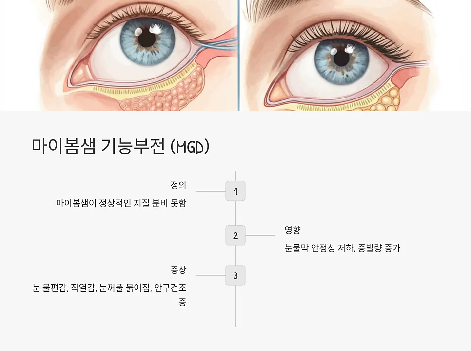 안검염 증상과 원인 #8