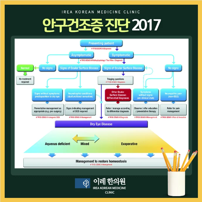 심한 안구건조증이 낫지 않는다면 쇼그렌증후군을 확인해보 #3