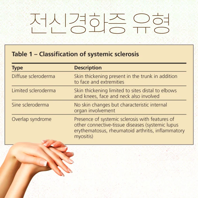 전신경화증과 쇼그렌증후군이 동시에 발생하는 경우의 특징 #2