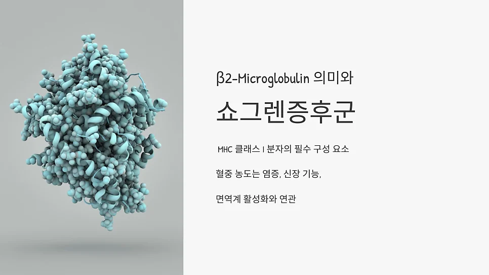 베타2 마이크로글로불린 상승, 쇼그렌증후군 활성도와 어 #1