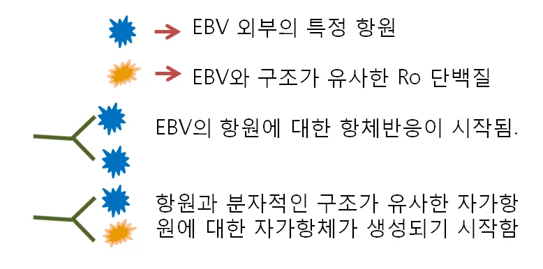 쇼그렌증후군 바이러스 감염 이후에 발생할 수 있습니다 - img_04