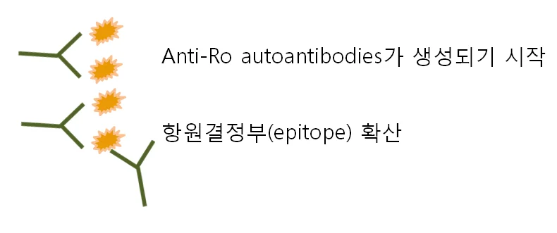 쇼그렌증후군 바이러스 감염 이후에 발생할 수 있습니다 - img_05