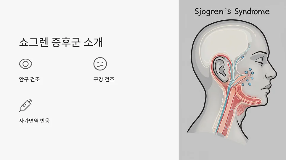 건선은 쇼그렌증후군 진단 위험을 높이는 자가면역질환입니 #4