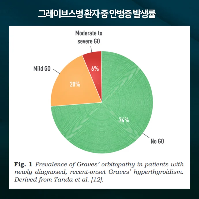 그레이브스병 환자 중 갑상선 안병증 발생률