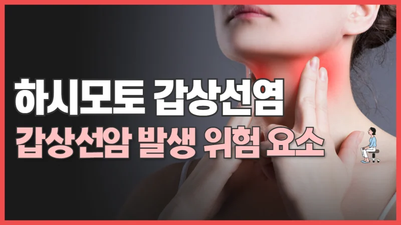 하시모토 갑상선염과 갑상선암 발생 위험