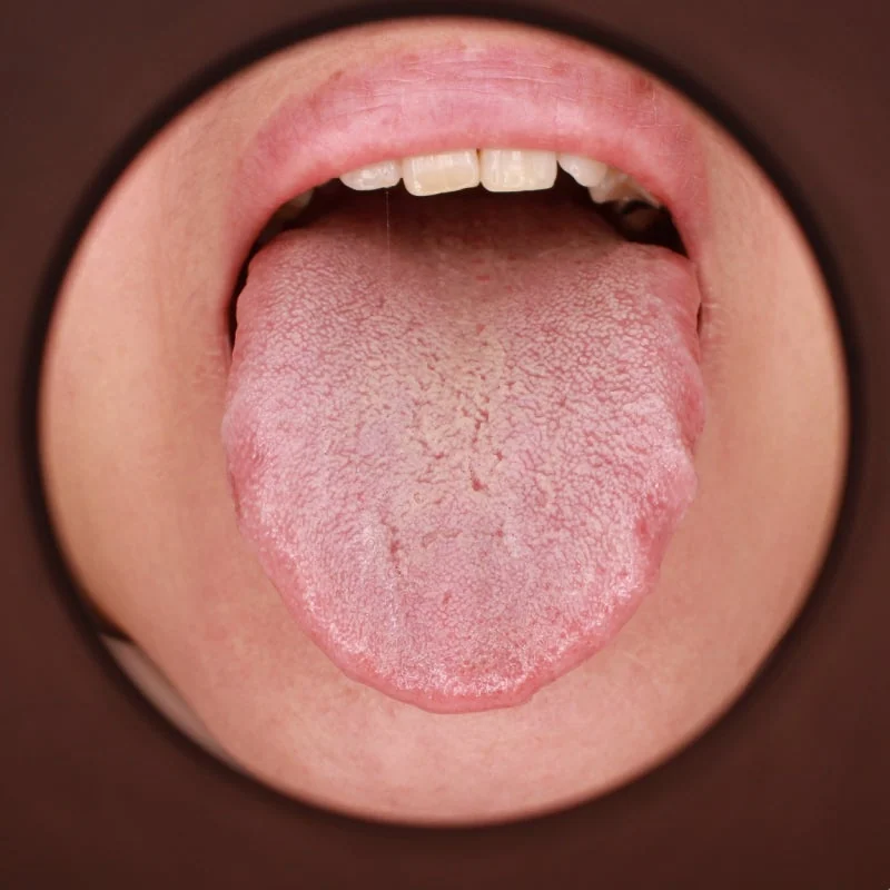 하시모토 갑상선염 치료 후 수치가 정상이 되었더라고 이것을 주의해야