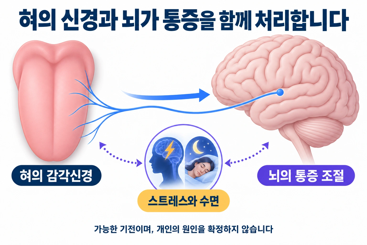 혀의 감각신경과 뇌의 통증 조절, 스트레스와 수면의 관계를 나타낸 개념도