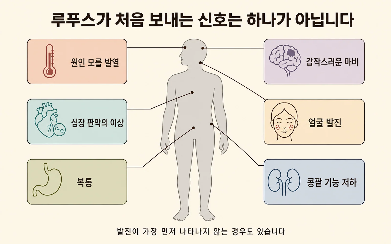 루푸스 초기 증상, 첫 신호가 발진이 아닐 때 — 원인 모를 발열로 시작된 사례