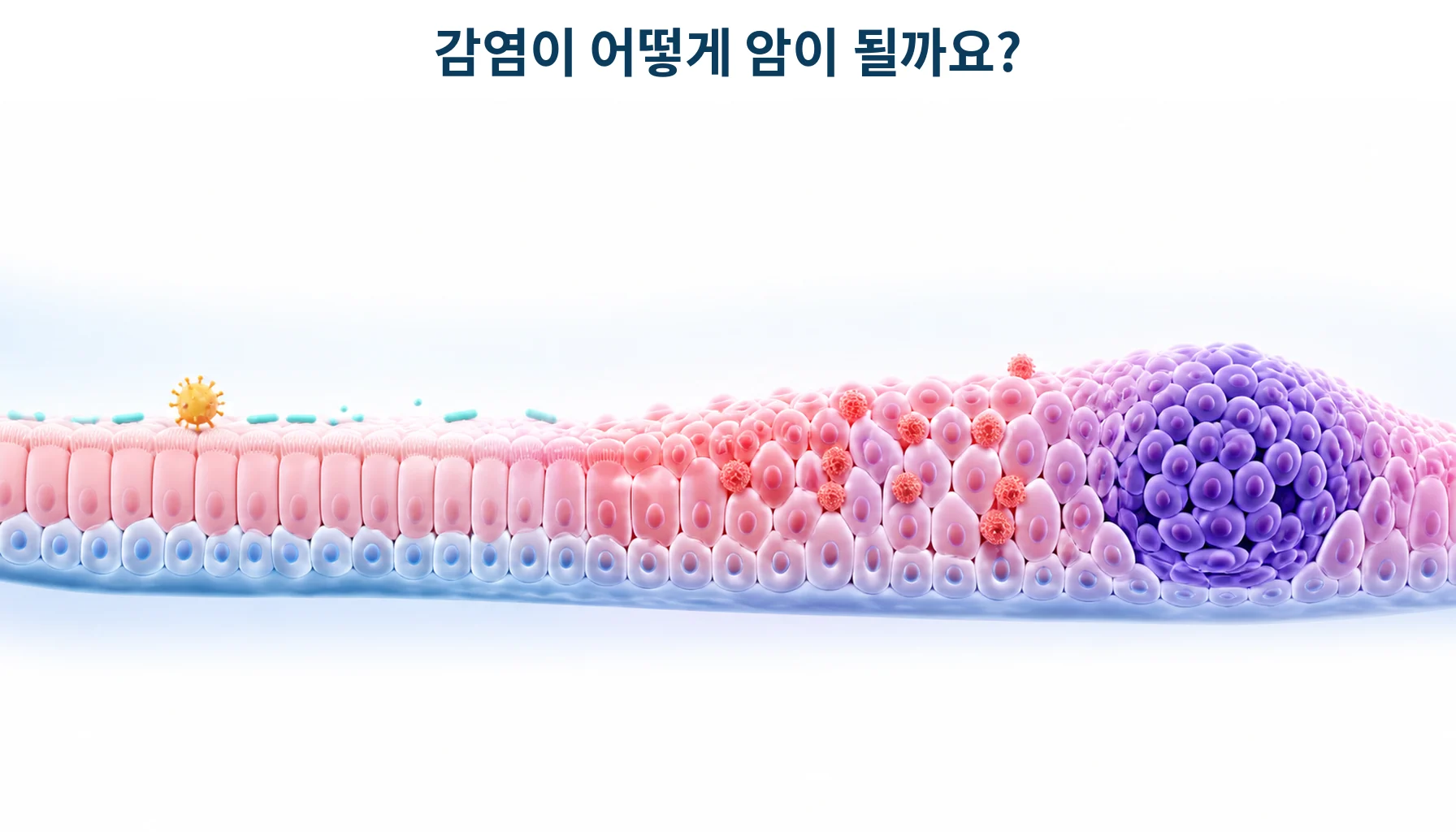 발암성 감염: 헬리코박터·간염·HPV와 암 예방의 근거