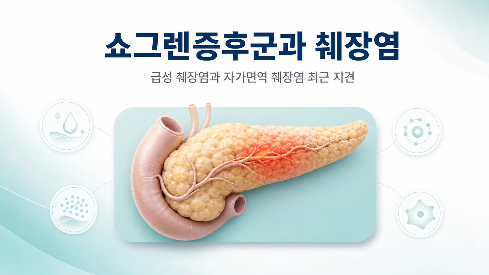 쇼그렌증후군의 급성 췌장염 위험과 췌장 기능 저하