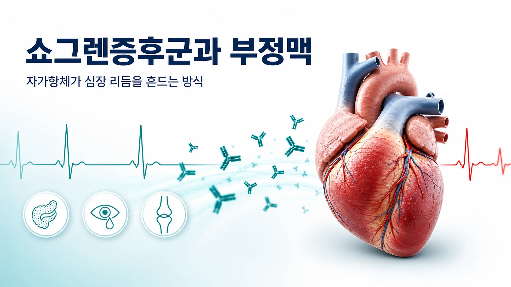 쇼그렌증후군의 부정맥 — 유병률과 종류, 이온 통로를 겨냥하는 자가항체의 분자 기전