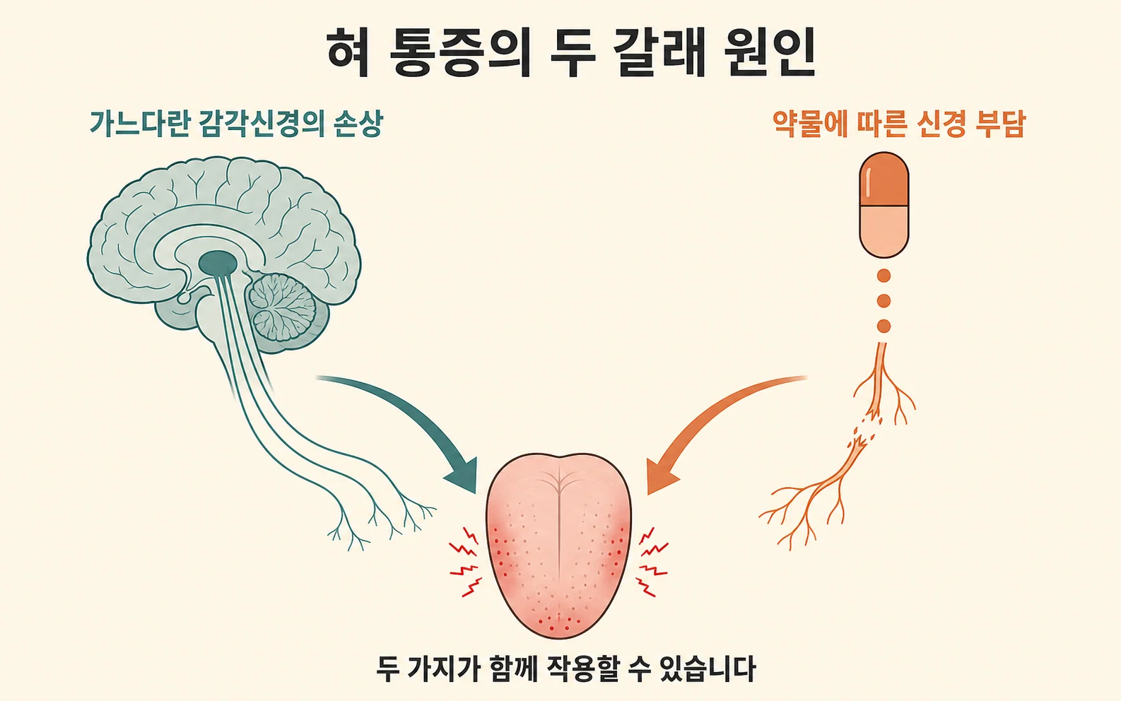 파킨슨병에서 혀가 화끈거린다면 — 가느다란 신경과 약, 두 갈래를 함께 봅니다