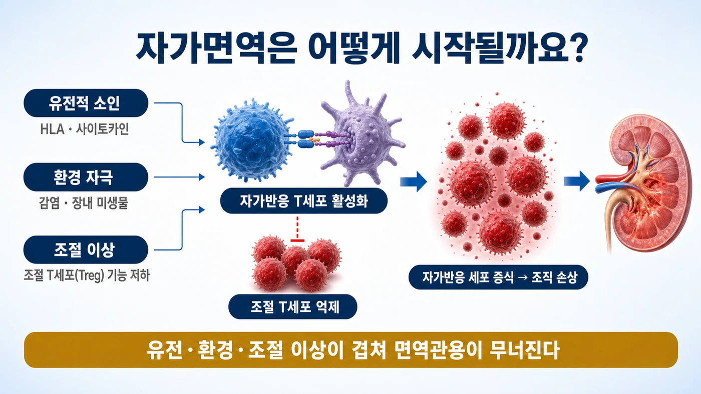 자가면역이 시작되는 공통 경로 — 유전적 소인, 환경 자극, 조절 T세포 기능 저하가 겹쳐 자가반응 T세포가 활성화되고 증식하며 조직을 손상시켜 면역관용이 무너지는 과정