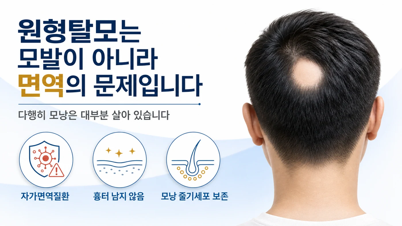 원형탈모는 모발이 아니라 면역의 문제이며 모낭은 대부분 살아 있다