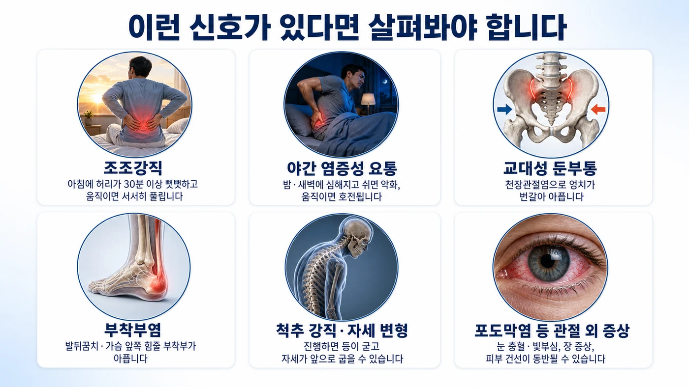 강직성 척추염의 주요 증상 — 조조강직, 야간 염증성 요통, 교대성 둔부통, 부착부염, 척추 강직·자세 변형, 포도막염 등 관절 외 증상