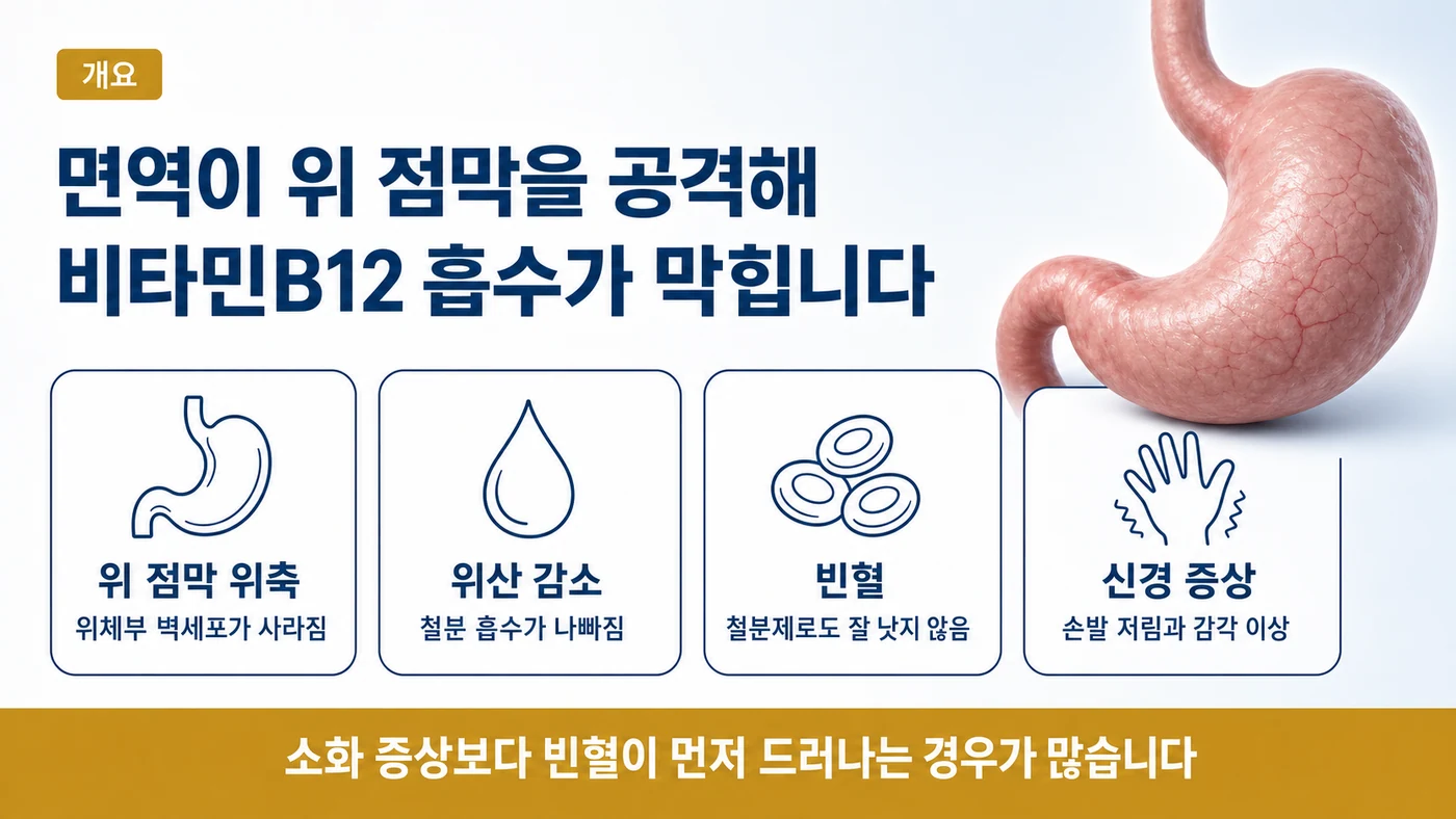 위 점막 위축, 위산 감소, 빈혈, 신경 증상으로 이어지는 자가면역성 위축성 위염의 흐름