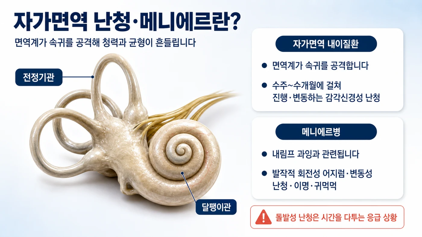 자가면역 난청·메니에르의 정의 도해. 면역계가 속귀를 공격하는 자가면역 내이질환과 내림프 과잉이 관련된 메니에르병을 비교하고, 돌발성 난청의 응급성을 안내합니다.