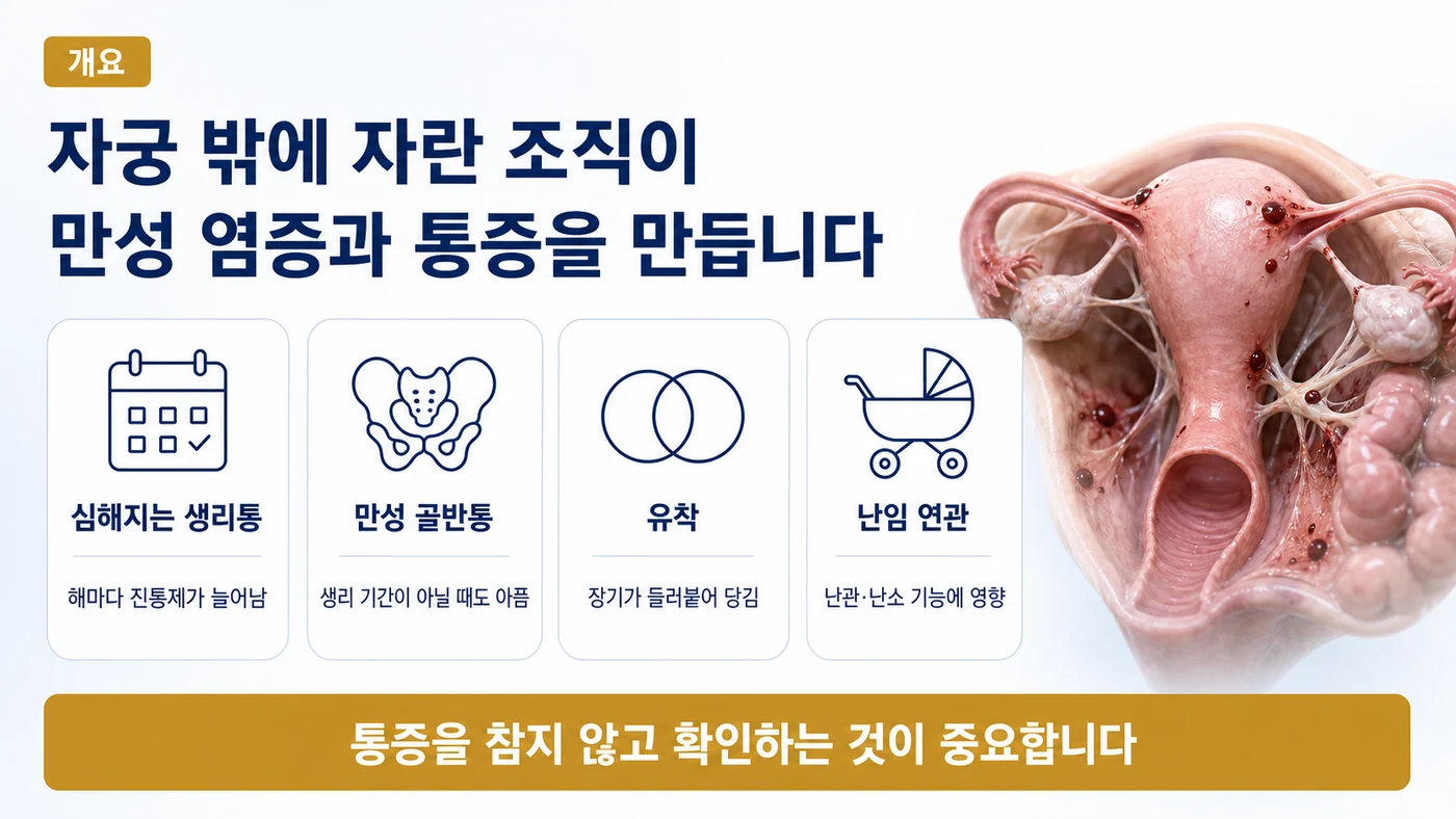 심해지는 생리통, 만성 골반통, 유착, 난임 연관으로 요약되는 자궁내막증의 특징