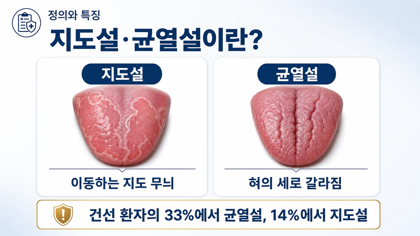 지도설·균열설이란 — 지도설은 이동하는 지도 무늬, 균열설은 혀의 세로 갈라짐으로 나타나며 건선 환자의 33%에서 균열설, 14%에서 지도설이 관찰됨