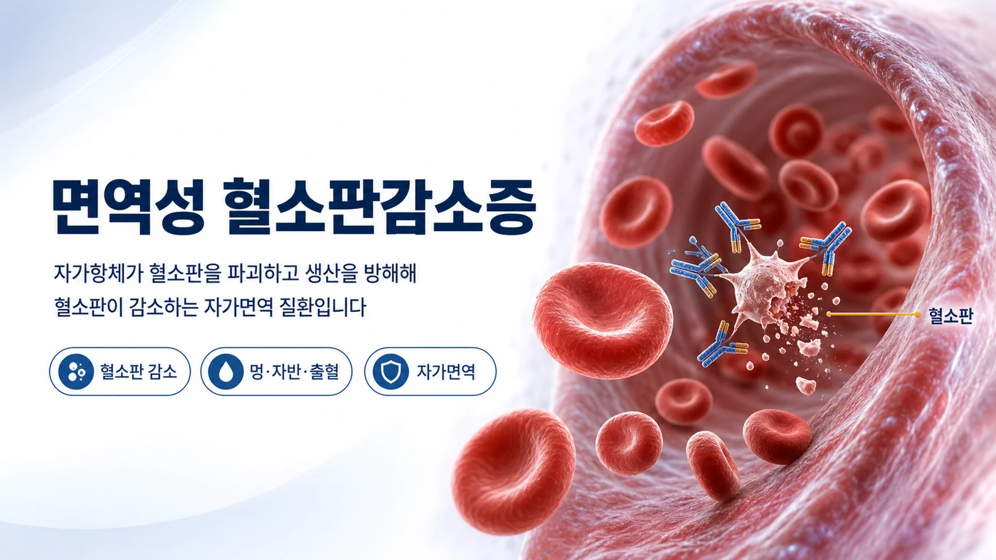 면역성 혈소판감소증 대표 이미지. 자가항체가 혈소판을 파괴하고 생산을 방해해 혈소판이 감소하는 자가면역 질환임을 혈관 속 자가항체와 혈소판으로 보여줍니다.