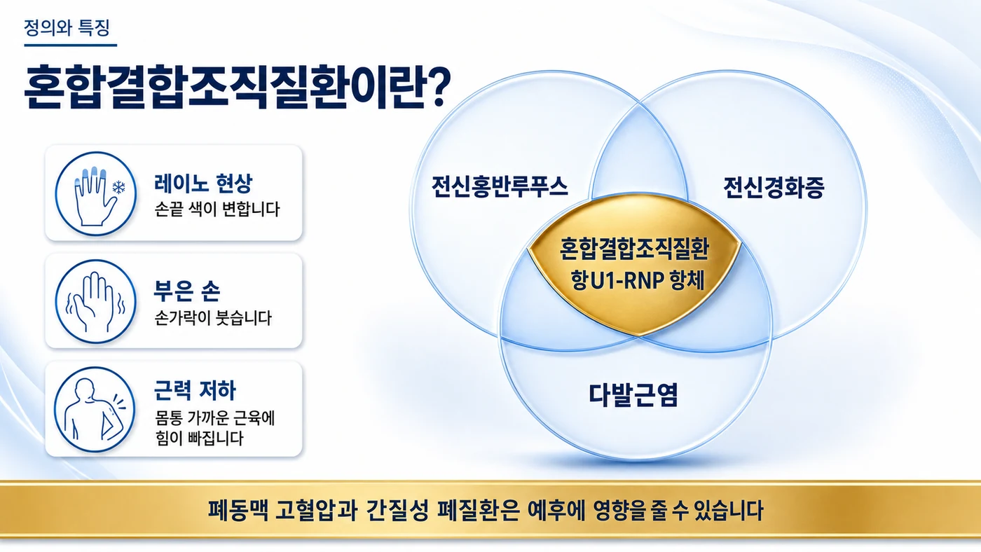 혼합결합조직질환이란 — 전신홍반루푸스·전신경화증·다발근염의 특징이 겹치고 항U1-RNP 항체가 확인되는 중복 증후군