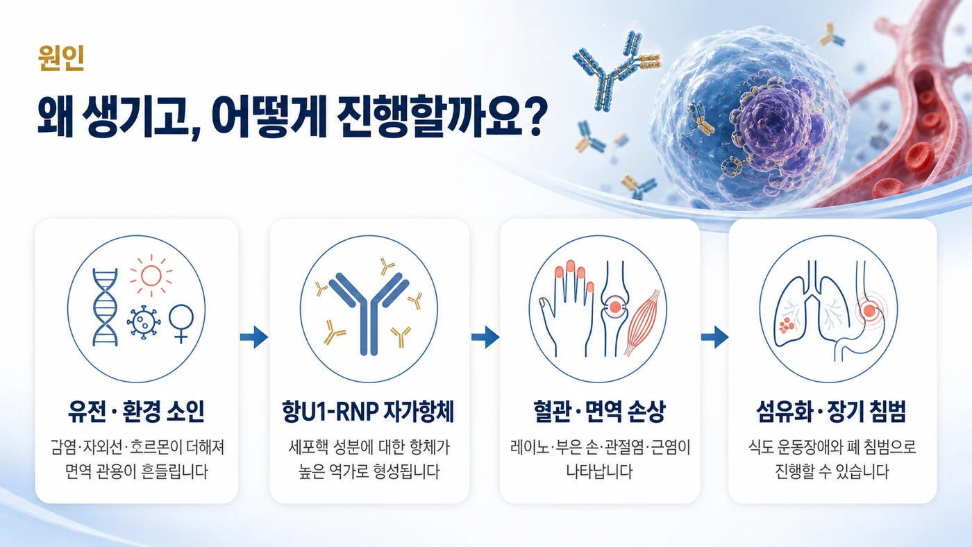 혼합결합조직질환의 원인 — 유전·환경 소인에서 항U1-RNP 자가항체 형성, 혈관·면역 손상, 섬유화와 장기 침범으로 이어지는 흐름