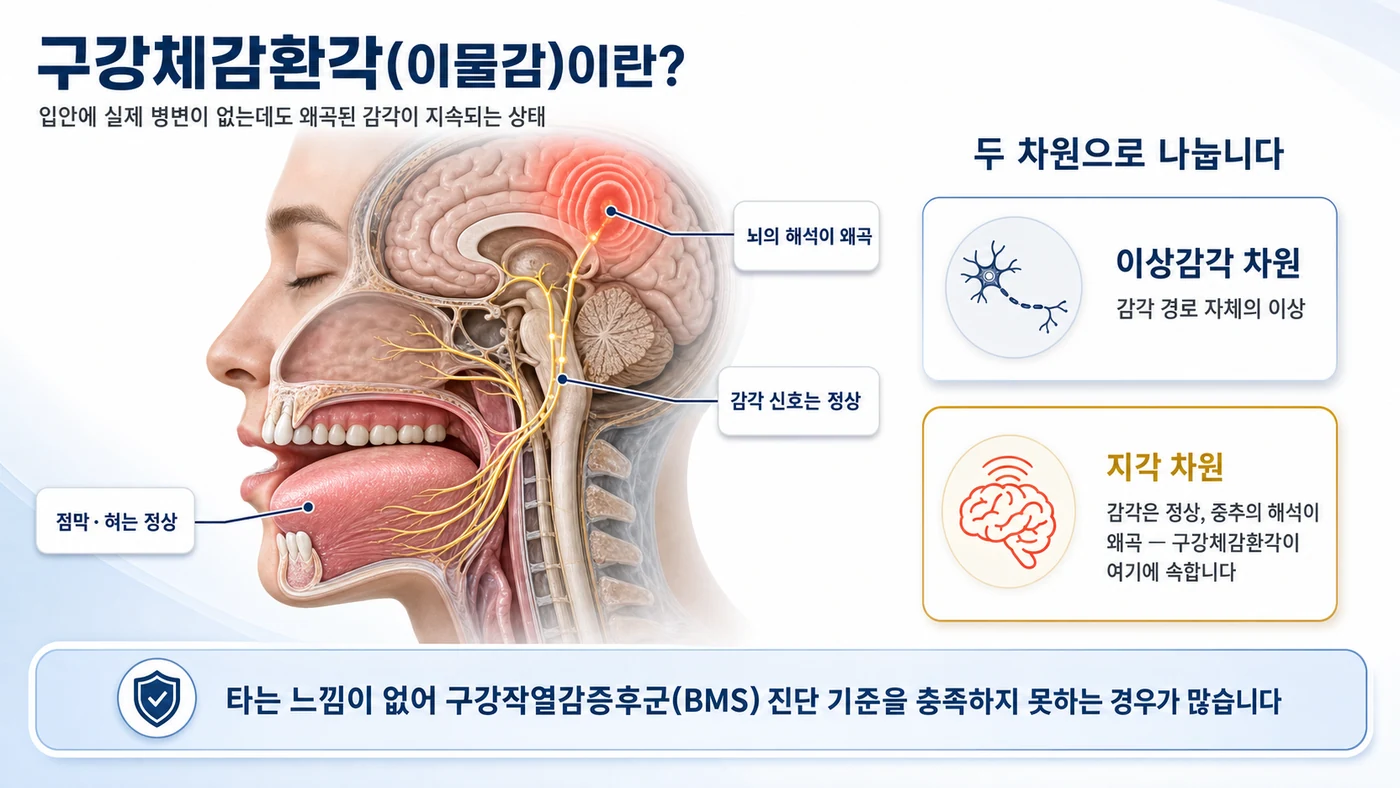 점막과 감각 신호는 정상이지만 뇌의 해석이 왜곡되는 지각 차원 문제를 보여주는 해부 도해