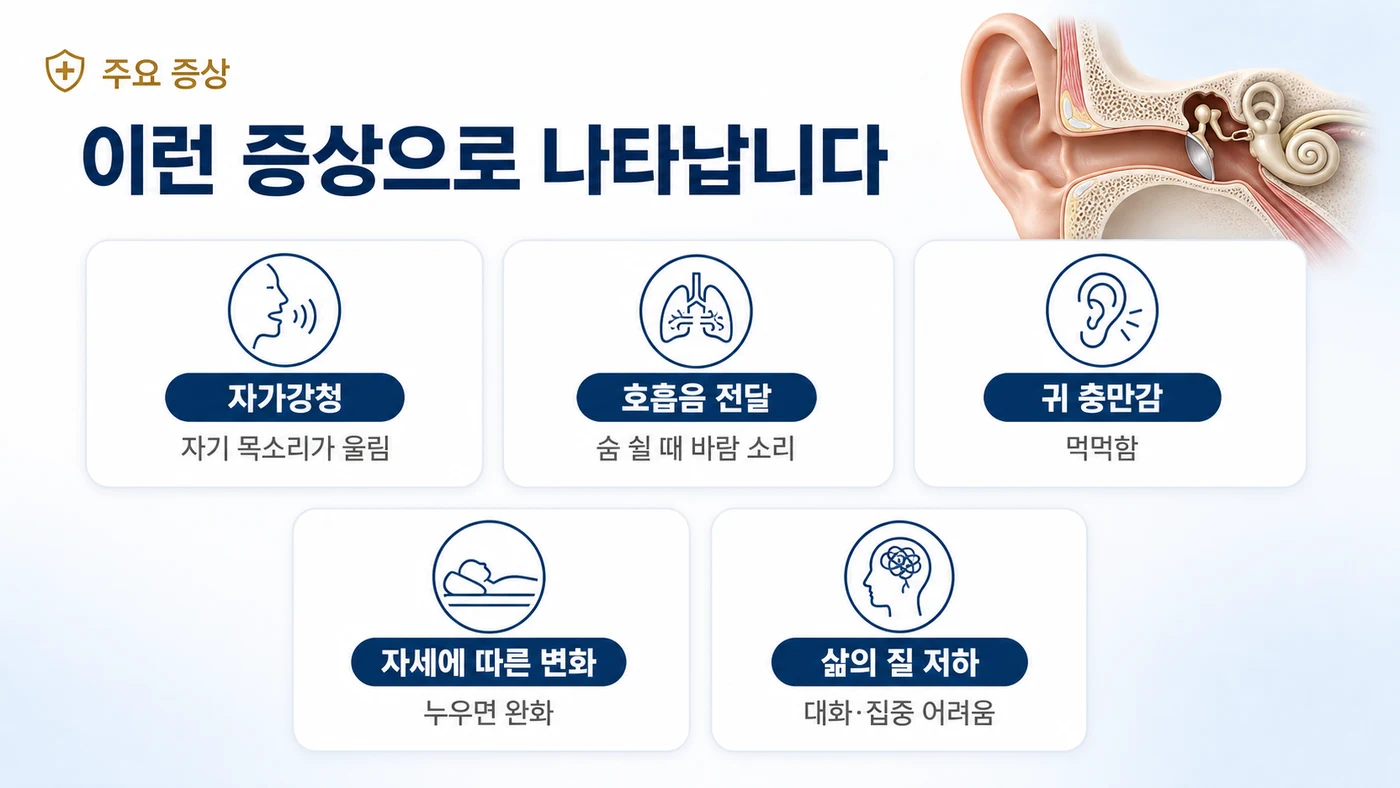 이관개방증의 주요 증상 — 자기 목소리가 울리는 자가강청, 숨 쉴 때 바람 소리, 귀 충만감, 누우면 완화되는 자세 의존성, 대화·집중 곤란으로 인한 삶의 질 저하