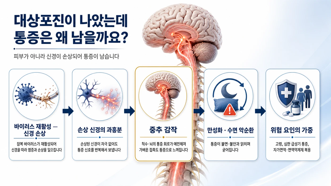 바이러스 재활성으로 손상된 신경의 과흥분과 중추 감작을 거쳐 통증이 만성화되는 과정