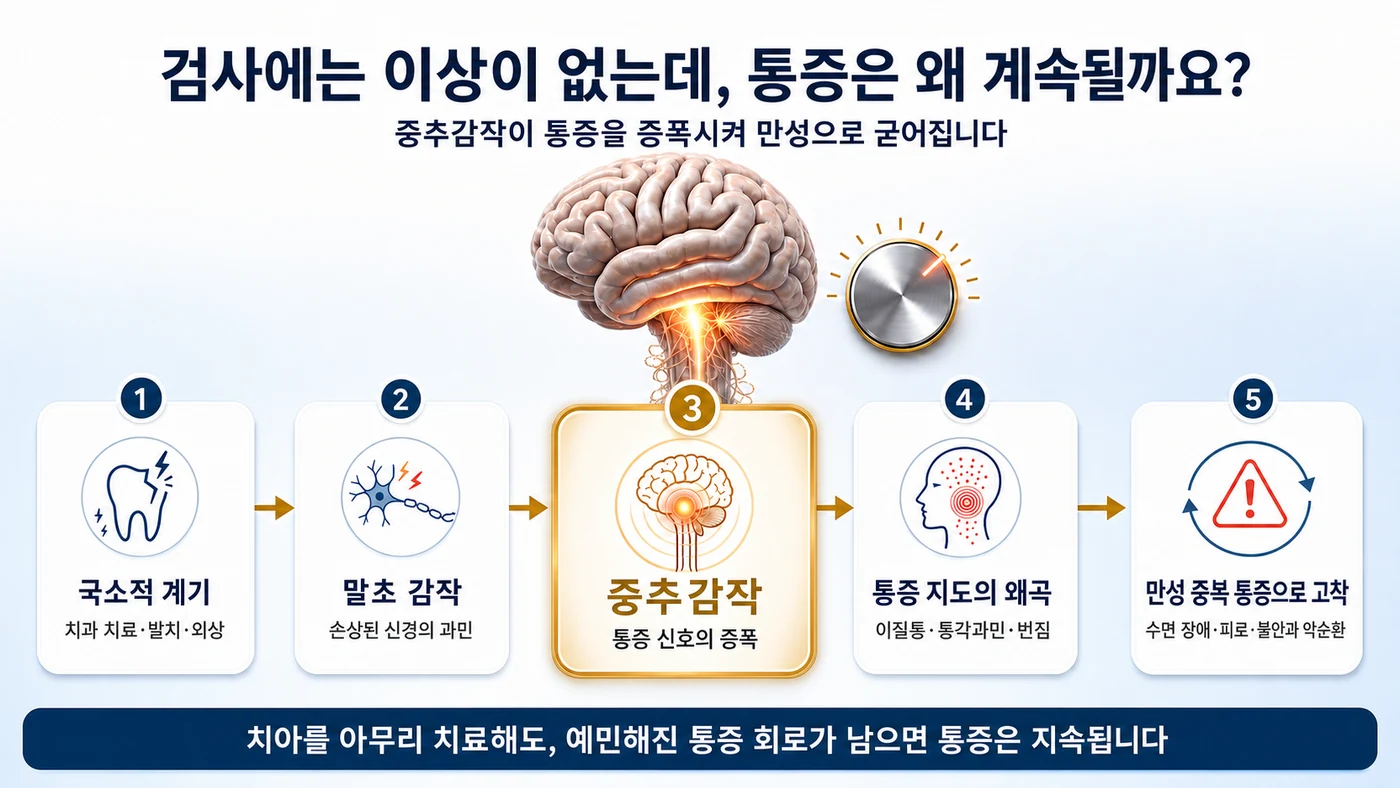 지속특발치조골통의 원인 — 국소적 계기에서 중추감작을 거쳐 만성 중복 통증으로 굳어지는 과정
