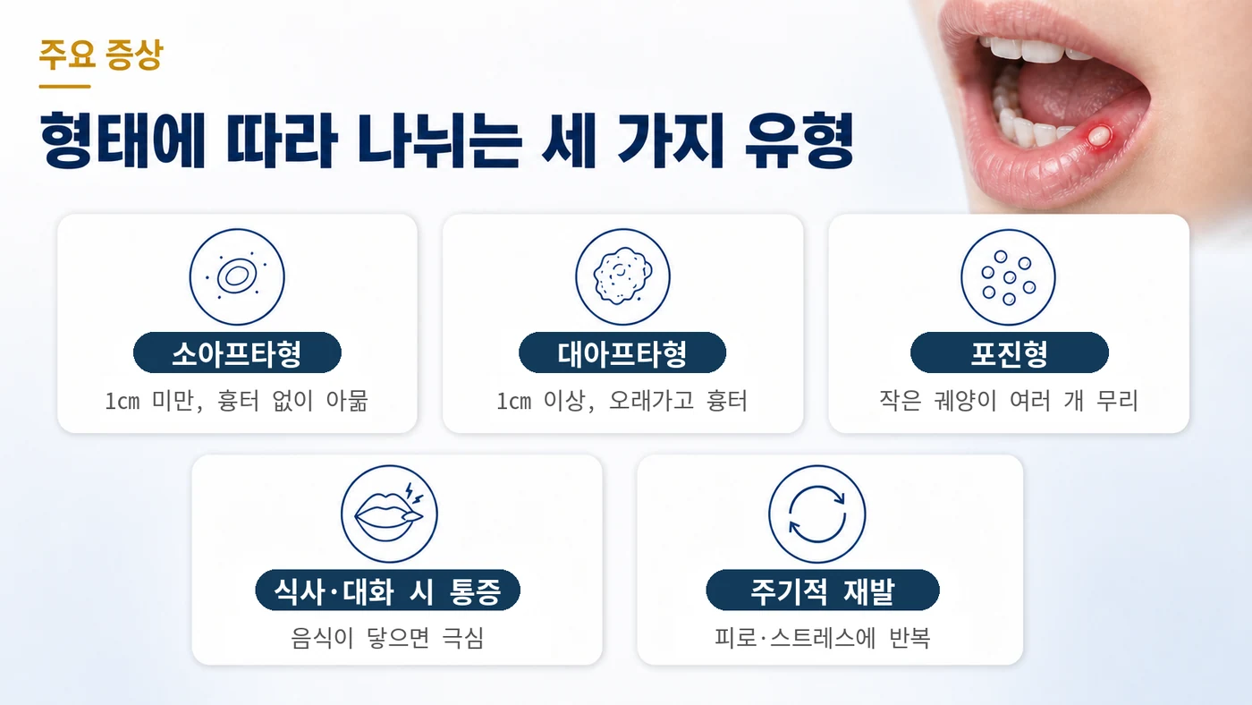 재발성 아프타성 구내염의 주요 증상 — 소아프타형, 대아프타형, 포진형의 세 유형과 식사·대화 시 통증, 주기적 재발