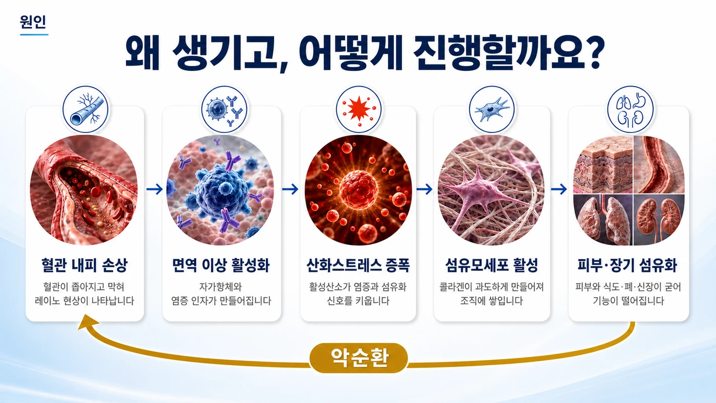 전신경화증의 원인 — 혈관 내피 손상, 면역 이상 활성화, 산화스트레스 증폭, 섬유모세포 활성, 피부·장기 섬유화로 이어지는 악순환