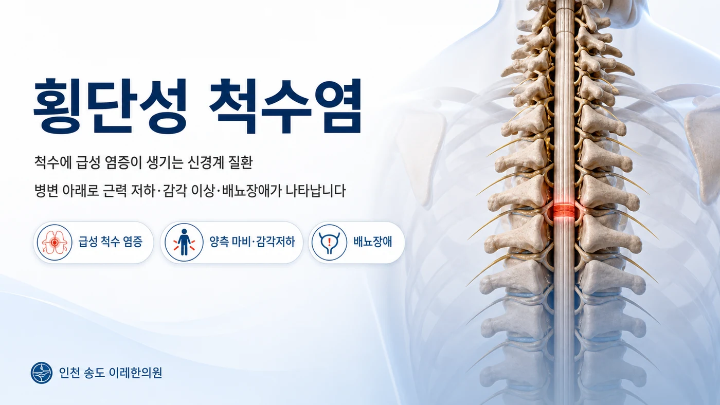 횡단성 척수염 대표 이미지 — 척수 한 부위에 생긴 급성 염증과 병변 아래로 나타나는 근력 저하·감각 이상·배뇨장애