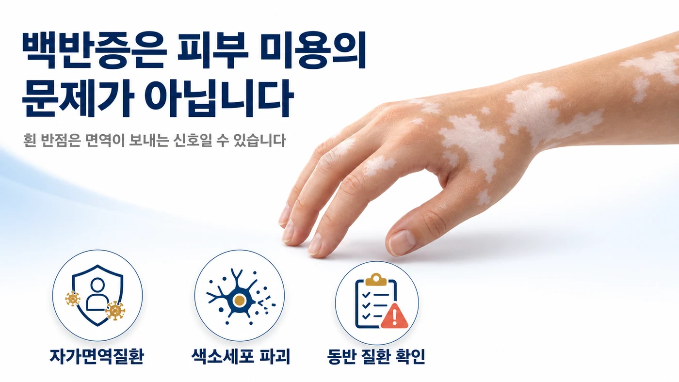 백반증은 피부 미용의 문제가 아니라 자가면역질환이며 흰 반점은 면역이 보내는 신호일 수 있다