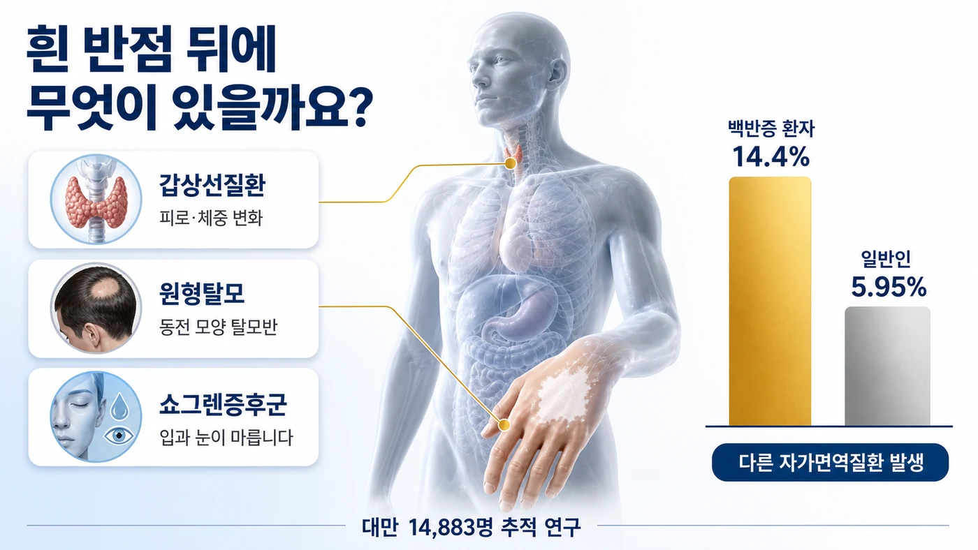백반증 환자에게 동반될 수 있는 갑상선질환·원형탈모·쇼그렌증후군과 자가면역질환 발생률 비교